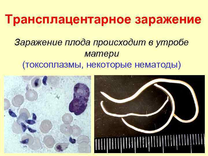 Трансплацентарное заражение Заражение плода происходит в утробе матери (токсоплазмы, некоторые нематоды) 