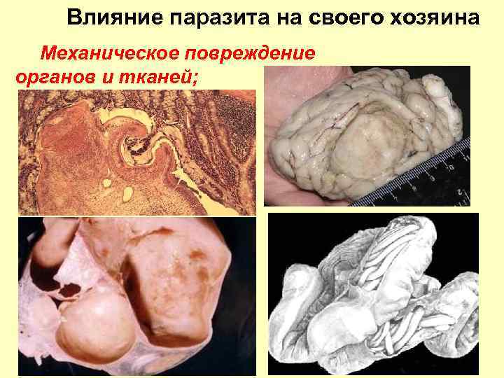 Влияние паразита на своего хозяина Механическое повреждение органов и тканей; 