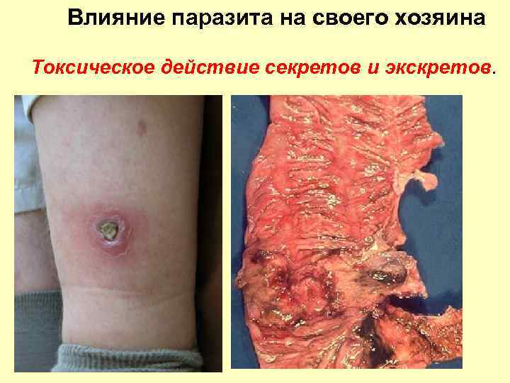 Влияние паразита на своего хозяина Токсическое действие секретов и экскретов. 