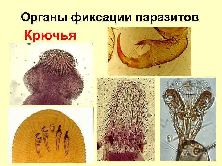 Органы фиксации паразитов Крючья 
