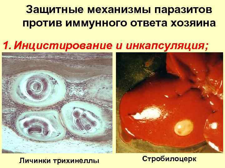 Защитные механизмы паразитов против иммунного ответа хозяина 1. Инцистирование и инкапсуляция; Личинки трихинеллы Стробилоцерк