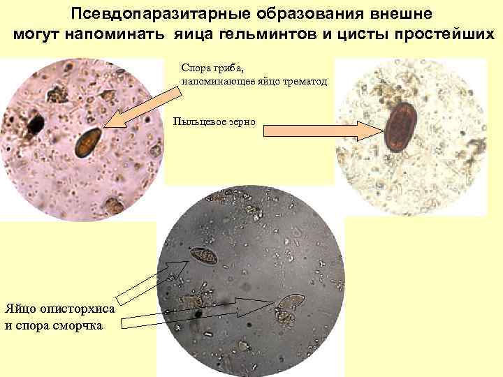 Псевдопаразитарные образования внешне могут напоминать яица гельминтов и цисты простейших Спора гриба, напоминающее яйцо