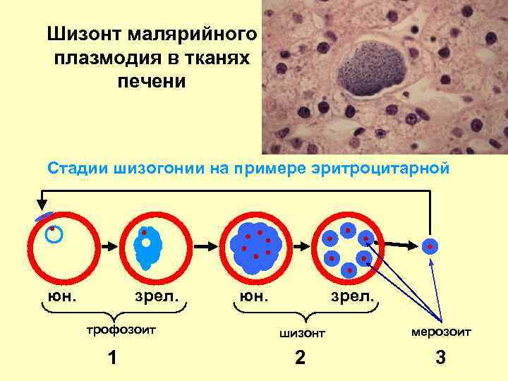 Малярийный плазмодий клиническая картина