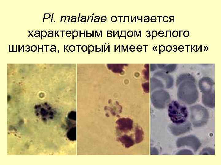 Pl. malariae отличается характерным видом зрелого шизонта, который имеет «розетки» 