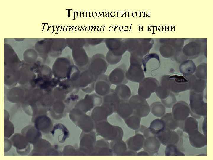 Трипомастиготы Тrypanosoma cruzi в крови 