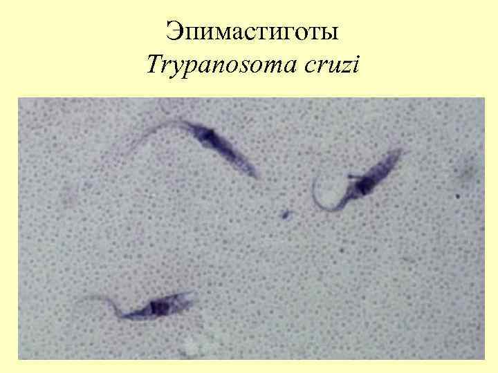 Эпимастиготы Тrypanosoma cruzi 