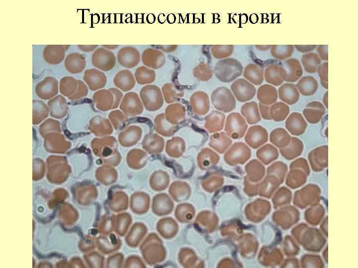 Трипаносомы в крови 