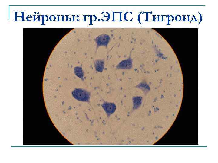 Нейроны: гр. ЭПС (Тигроид) 