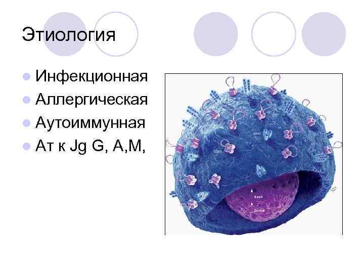 Болезнь хортона презентация