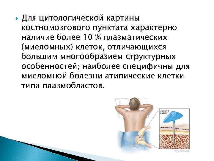  Для цитологической картины костномозгового пунктата характерно наличие более 10 % плазматических (миеломных) клеток,