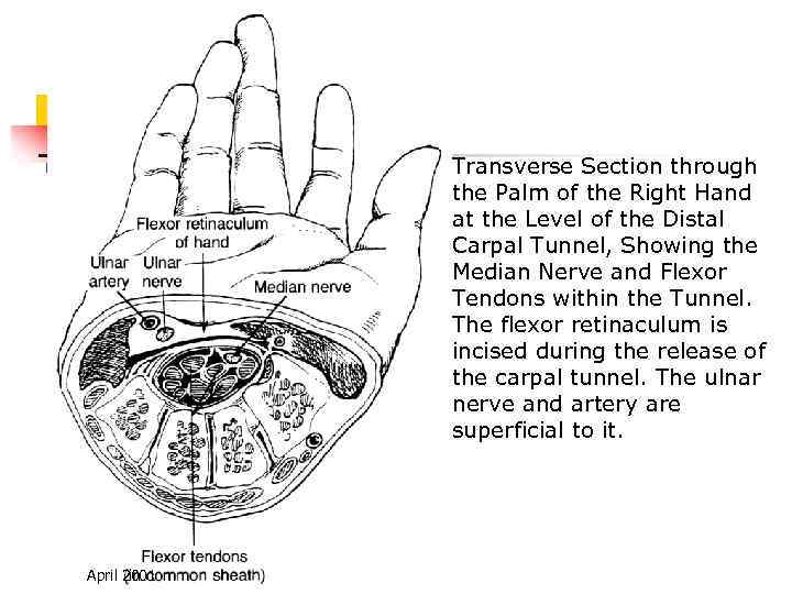 Transverse Section through the Palm of the Right Hand at the Level of the
