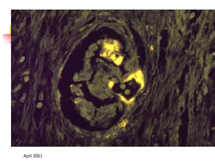 April 2001 