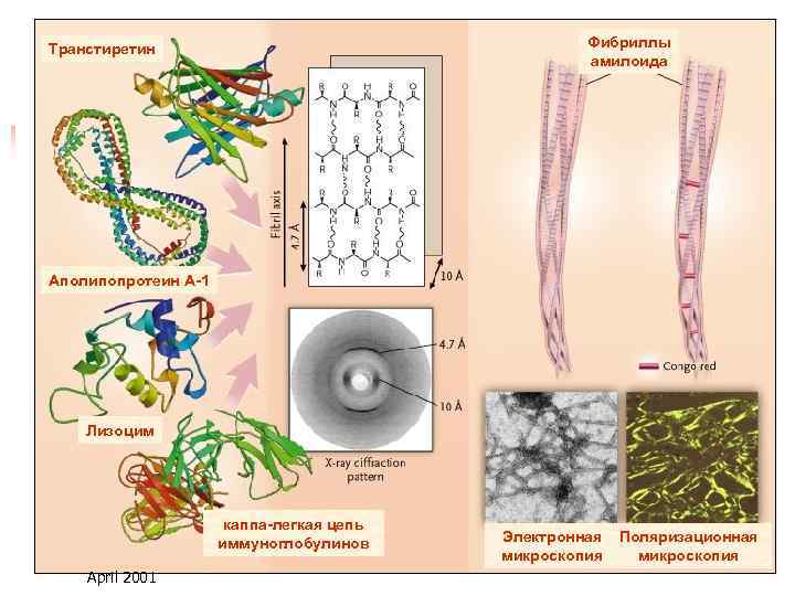 Фибриллы амилоида Транстиретин Аполипопротеин А-1 Лизоцим каппа-легкая цепь иммуноглобулинов April 2001 Электронная микроскопия Поляризационная