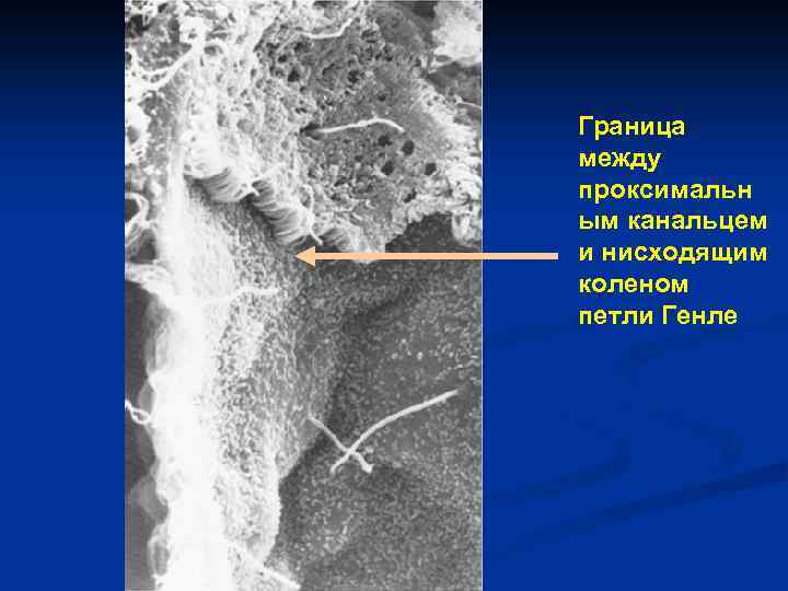 Граница между проксимальн ым канальцем и нисходящим коленом петли Генле 