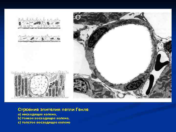 a b c Строение эпителия петли Генле a) нисходящее колено, b) тонкое восходящее колено,