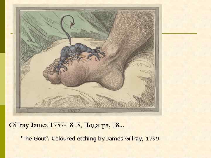 Gillray James 1757 -1815, Подагра, 18. . . 'The Gout'. Coloured etching by James