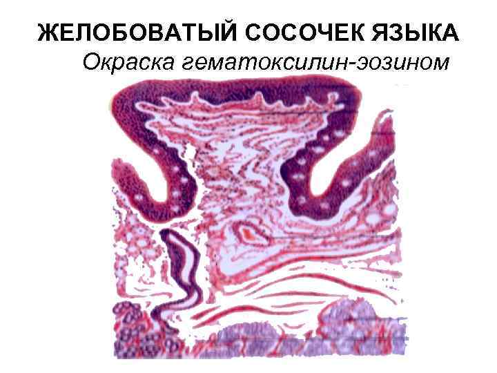 ЖЕЛОБОВАТЫЙ СОСОЧЕК ЯЗЫКА Окраска гематоксилин-эозином 