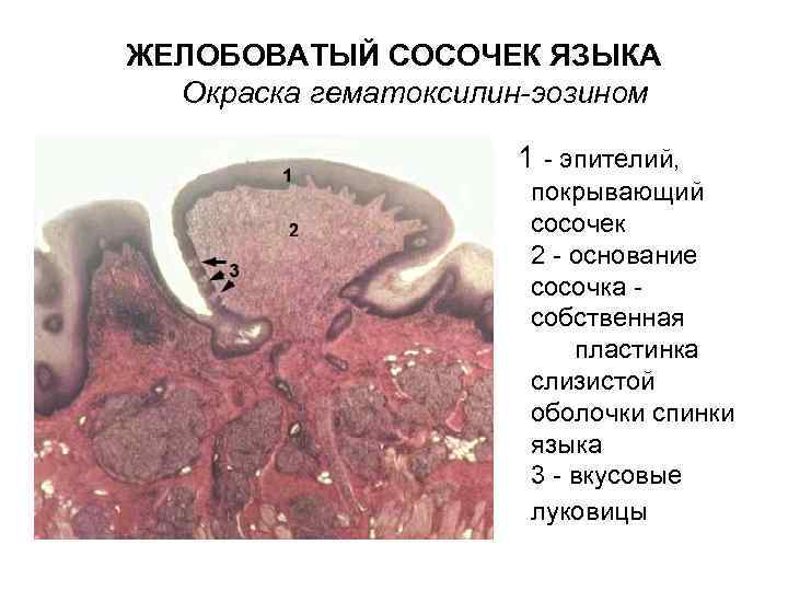 Атрофия сосочков языка фото