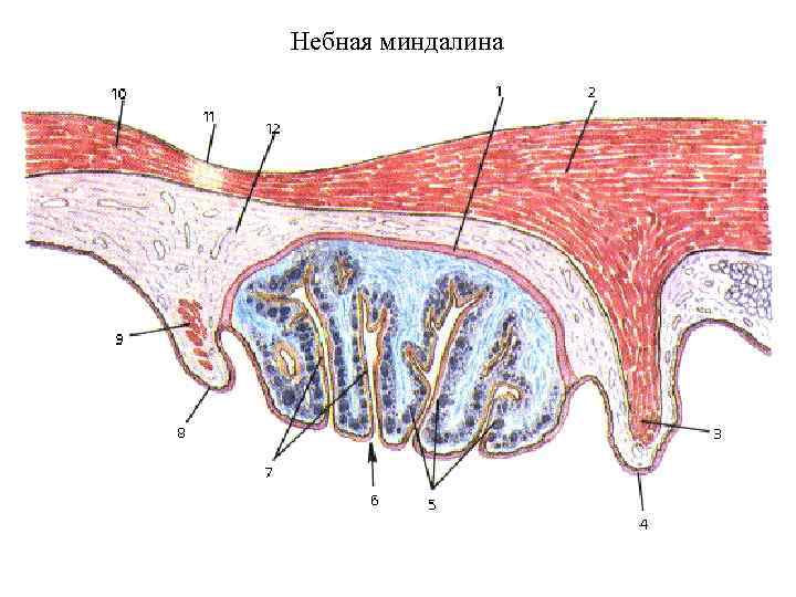 Небная миндалина 