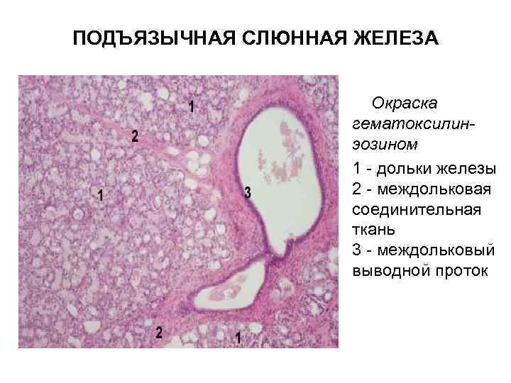 ПОДЪЯЗЫЧНАЯ СЛЮННАЯ ЖЕЛЕЗА • Окраска гематоксилинэозином • 1 - дольки железы 2 - междольковая