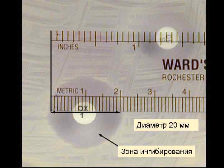 Диаметр 20 мм Зона ингибирования 