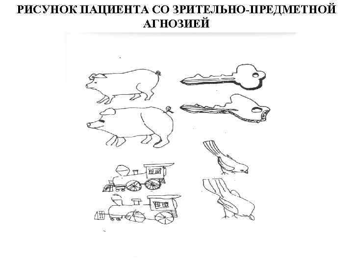 Вид агнозии характеризующийся нарушением узнавания предметов или их изображений выберите один ответ