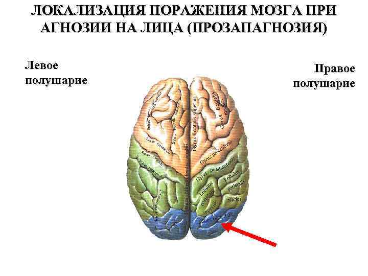 Локализация мозга