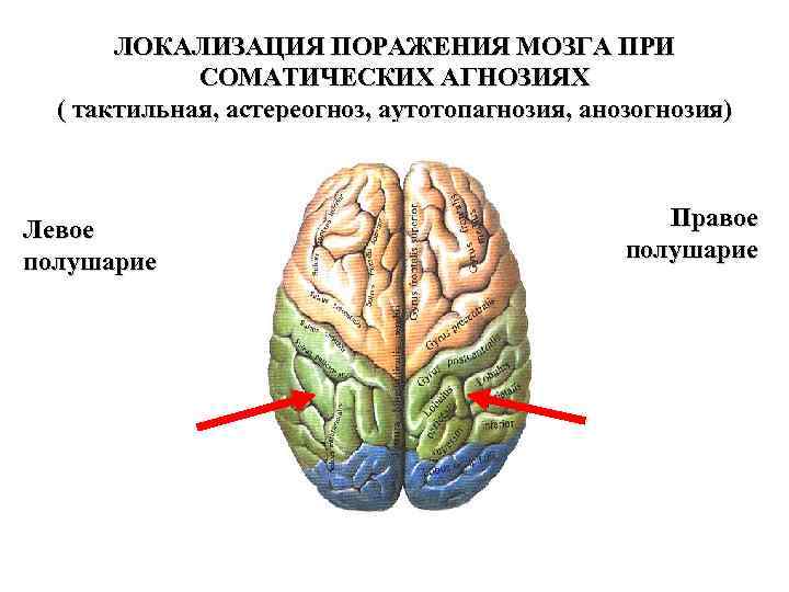 Тактильные агнозии презентация