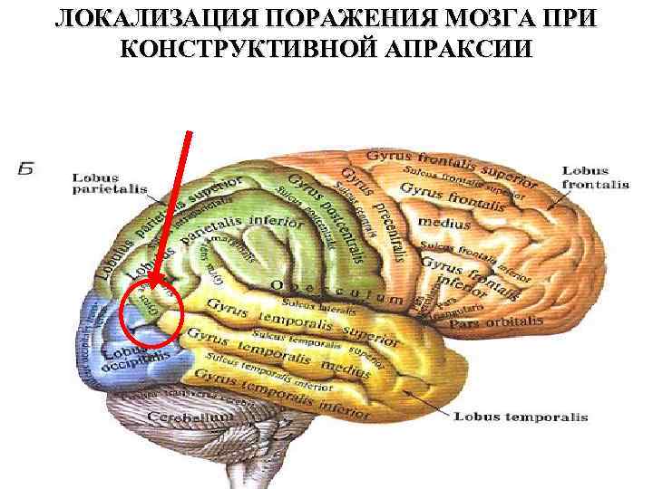 Локализация мозга. Локализация поражения мозга при конструктивной апраксии. Кинестетическая апраксия отделы мозга. Апраксия лобной доли. Регуляторная апраксия локализация поражения.