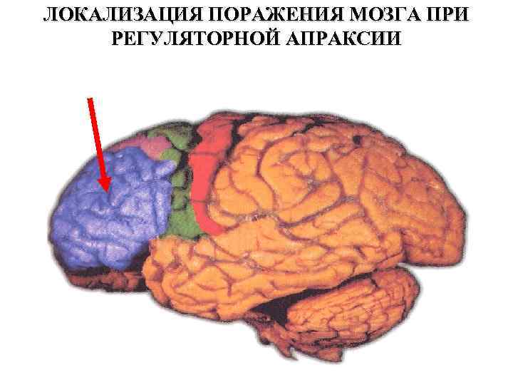 Локализация поражения