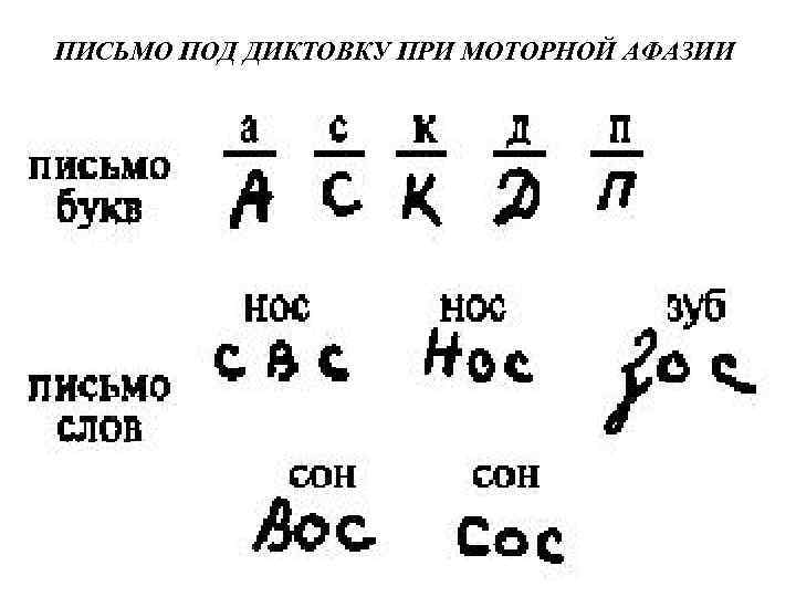 ПИСЬМО ПОД ДИКТОВКУ ПРИ МОТОРНОЙ АФАЗИИ 