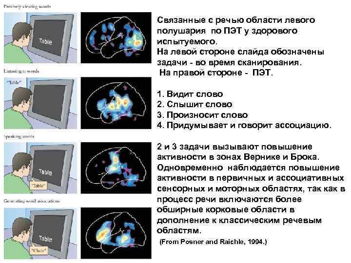 Связанные с речью области левого полушария по ПЭТ у здорового испытуемого. На левой стороне