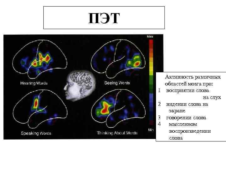 ПЭТ 1 2 3 4 Активность различных областей мозга при: восприятии слова на слух