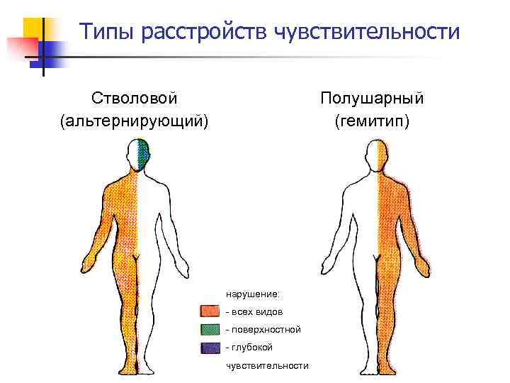 Типы расстройств чувствительности Стволовой (альтернирующий) Полушарный (гемитип) нарушение: - всех видов - поверхностной -