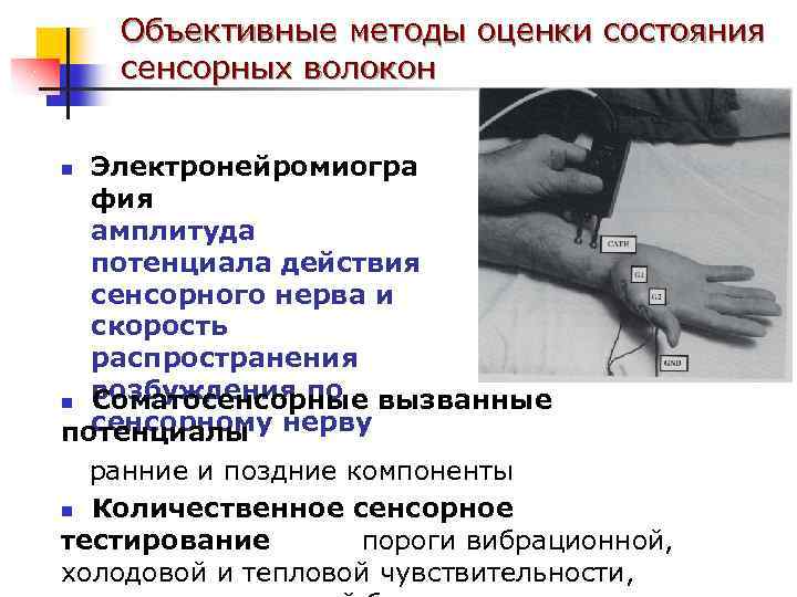 Объективные методы оценки состояния сенсорных волокон Электронейромиогра фия амплитуда потенциала действия сенсорного нерва и