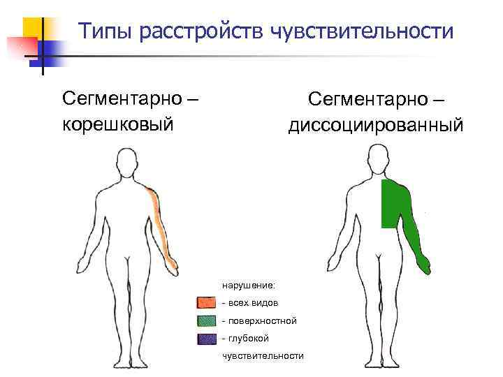 Типы расстройств чувствительности Сегментарно – корешковый Сегментарно – диссоциированный нарушение: - всех видов -