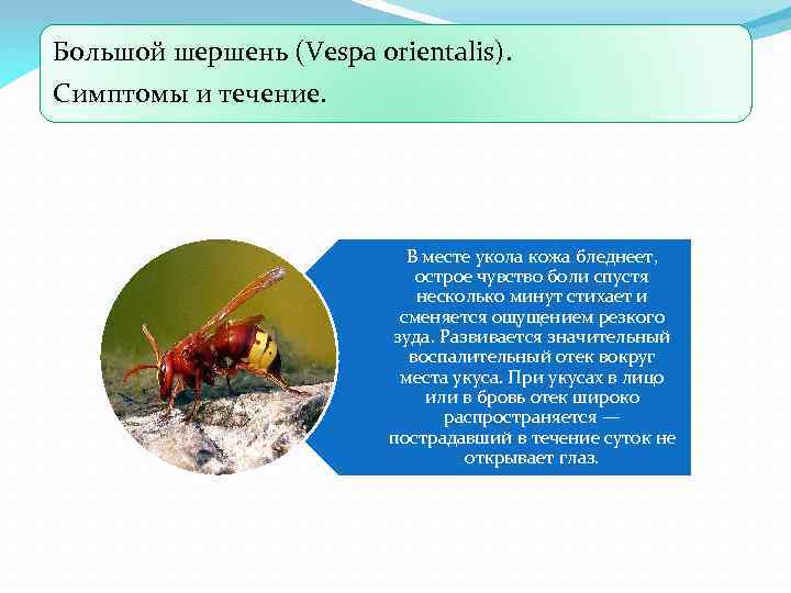 Большой шершень (Vespa orientalis). Симптомы и течение. В месте укола кожа бледнеет, острое чувство