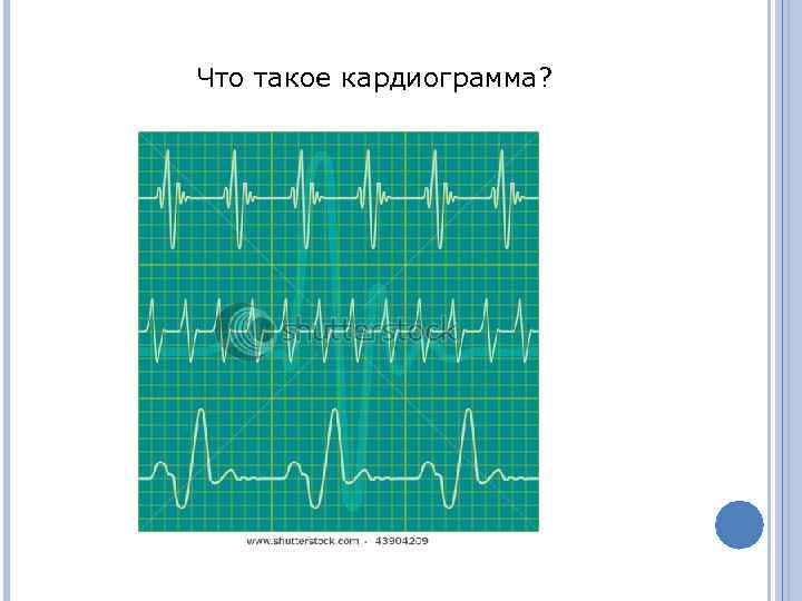 Что такое кардиограмма? 