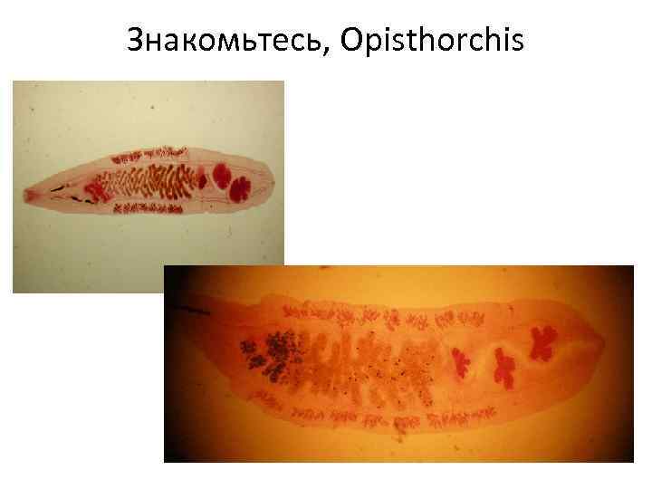 Знакомьтесь, Opisthorchis 