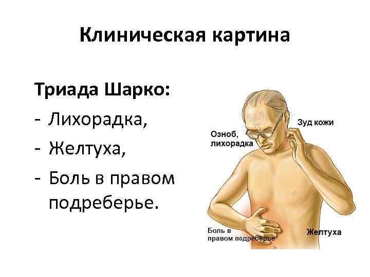 Клиническая картина Триада Шарко: - Лихорадка, - Желтуха, - Боль в правом подреберье. 