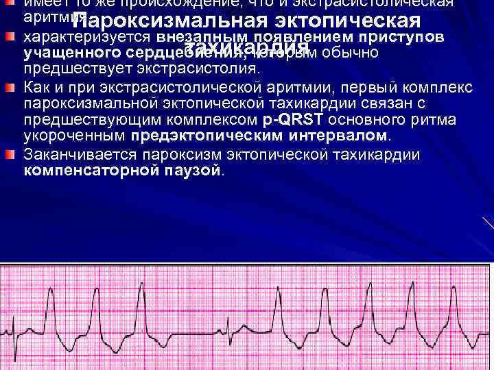 имеет то же происхождение, что и экстрасистолическая аритмия, Пароксизмальная эктопическая характеризуется внезапным появлением приступов