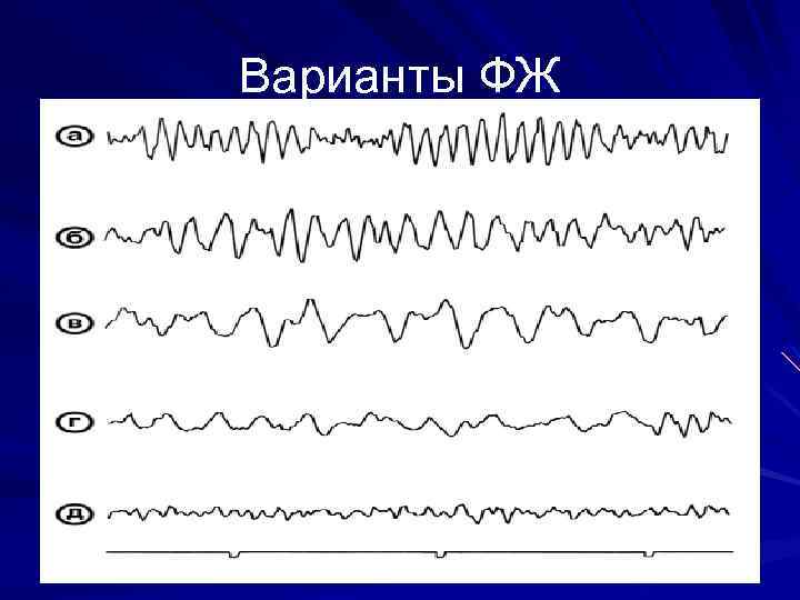 Варианты ФЖ 