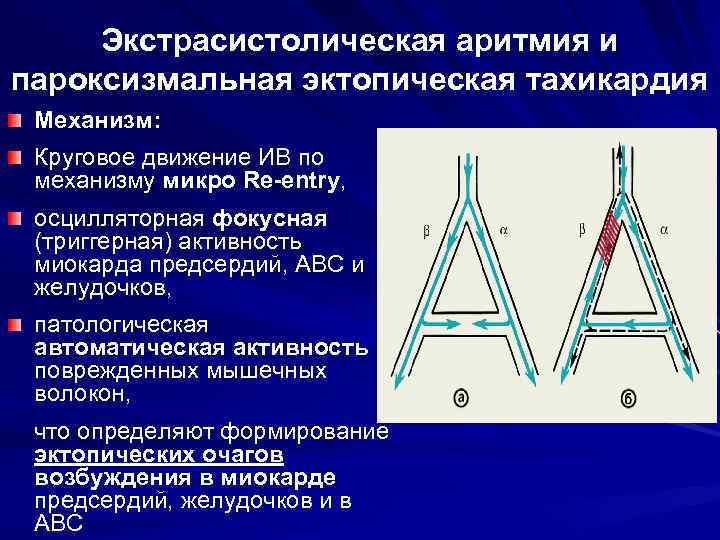 Экстрасистолическая аритмия и пароксизмальная эктопическая тахикардия Механизм: Круговое движение ИВ по механизму микро Re-entry,