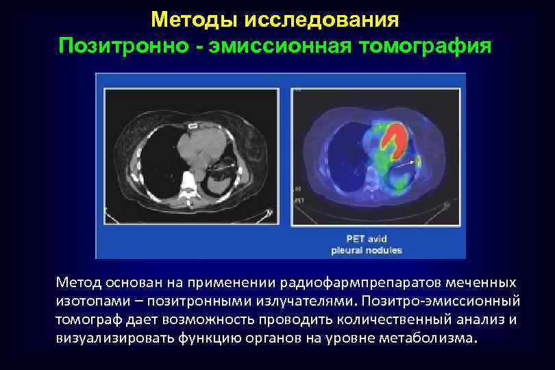 Методы позитронно эмиссионной томографии