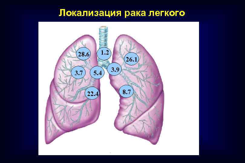 Часты легкие. Локализация легких 5. Локализация 13 правое легкое. Локализация легких у человека.