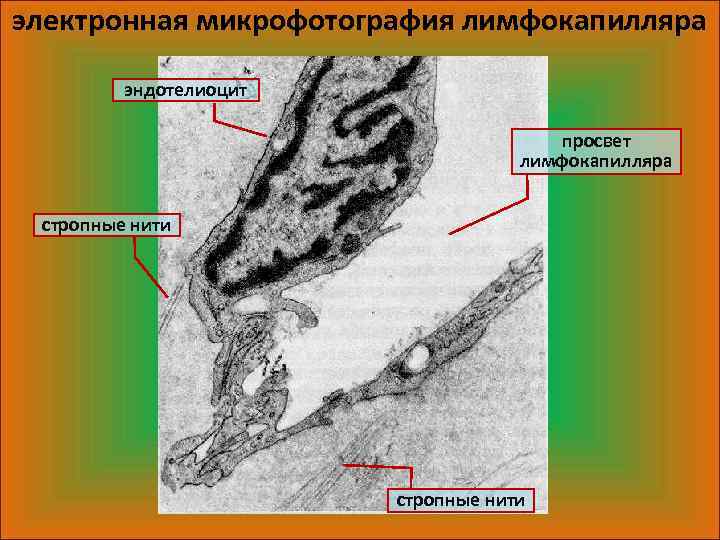 Для строения стенки лимфокапилляра характерно