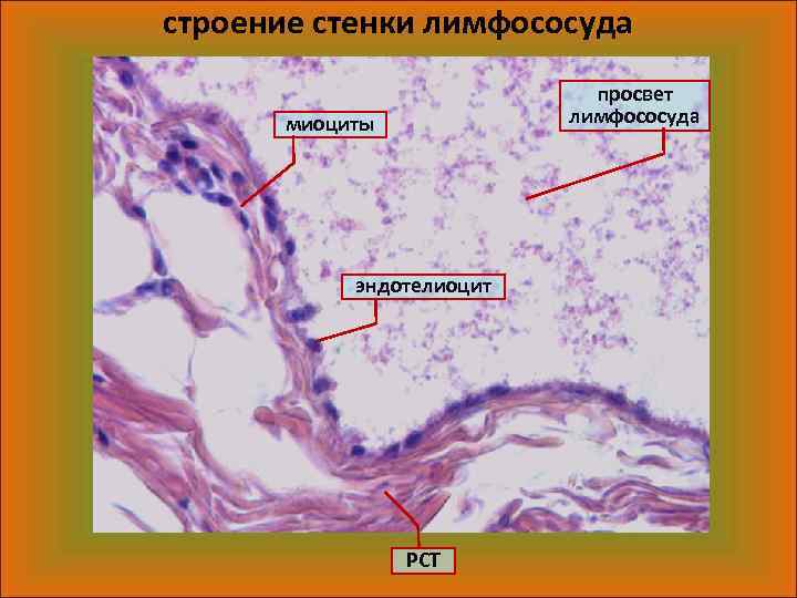строение стенки лимфососуда просвет лимфососуда миоциты эндотелиоцит РСТ 