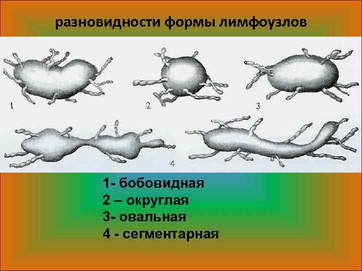 разновидности формы лимфоузлов 1 - бобовидная 2 – округлая 3 - овальная 4 -
