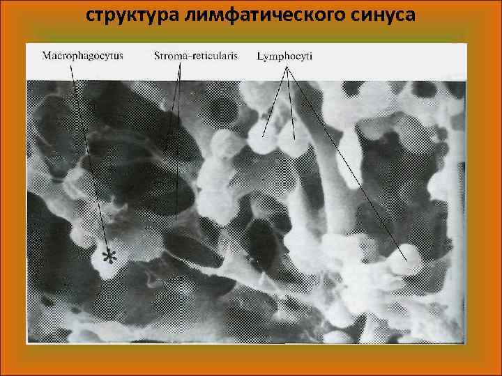 структура лимфатического синуса 