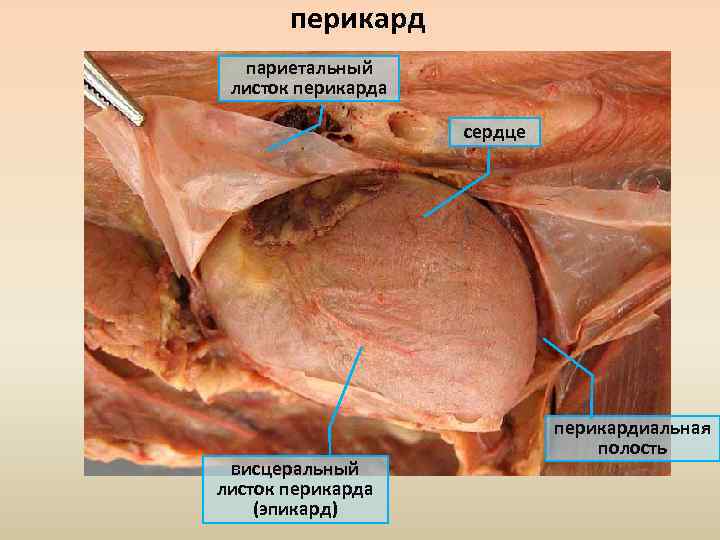 перикард париетальный листок перикарда сердце висцеральный листок перикарда (эпикард) перикардиальная полость 